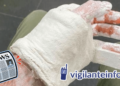 Un vigilante comienza el año con un dedo roto
