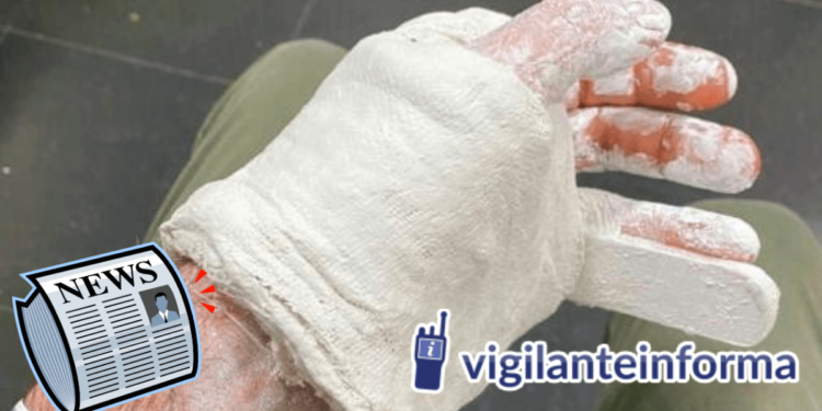 Un vigilante comienza el año con un dedo roto